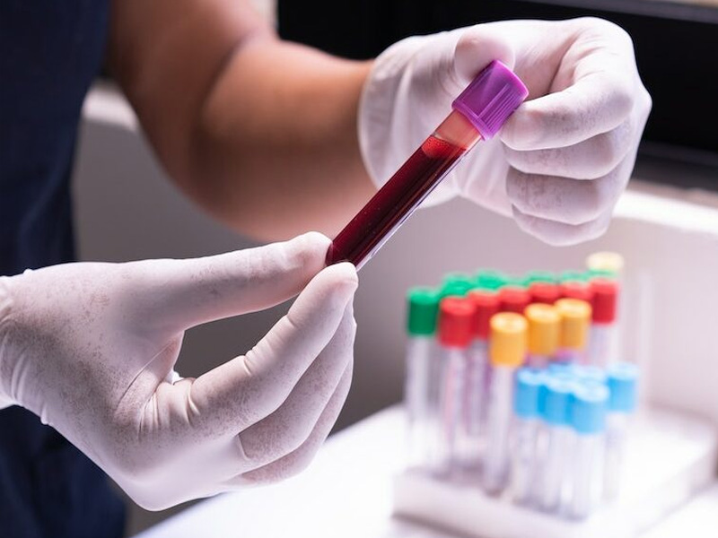 Person Holding a Blood Sample in a Test Tube